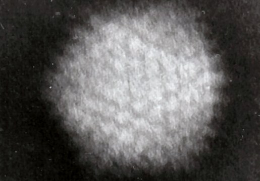 Adenovirus_4.jpg